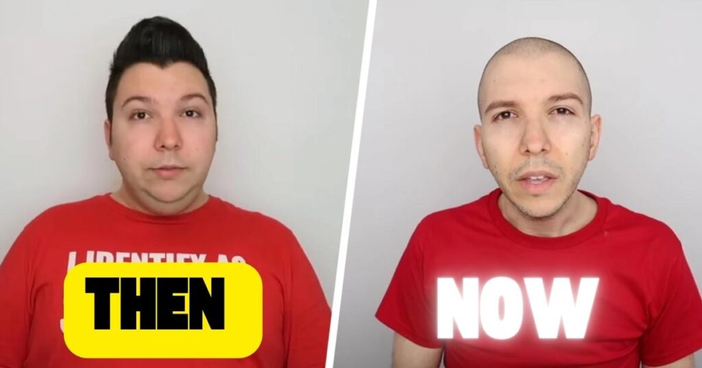 Nikocado Avocado's Weight Journey: Then vs. Now
